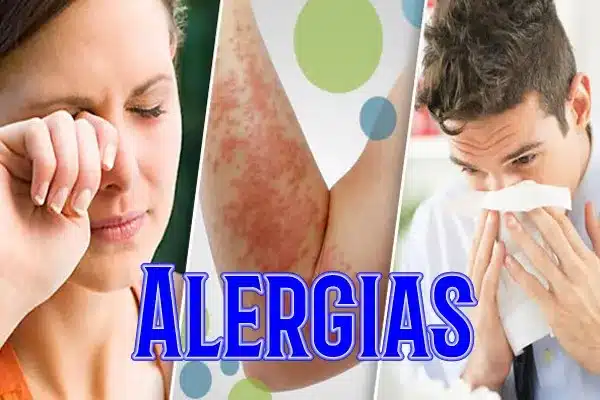 alergias 2 ¿Cómo curar las alergias? Terapia alternativa en Mijas